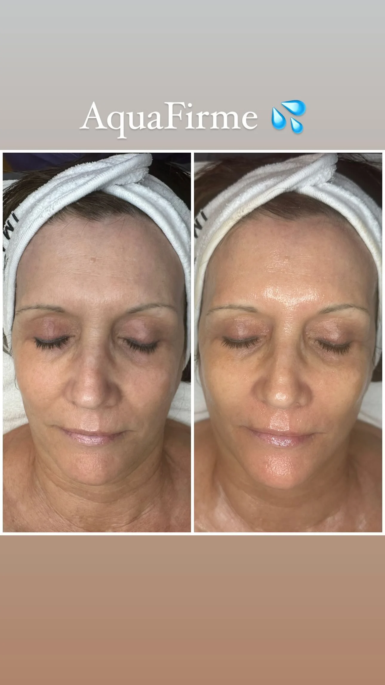 AquaFirme before and after result