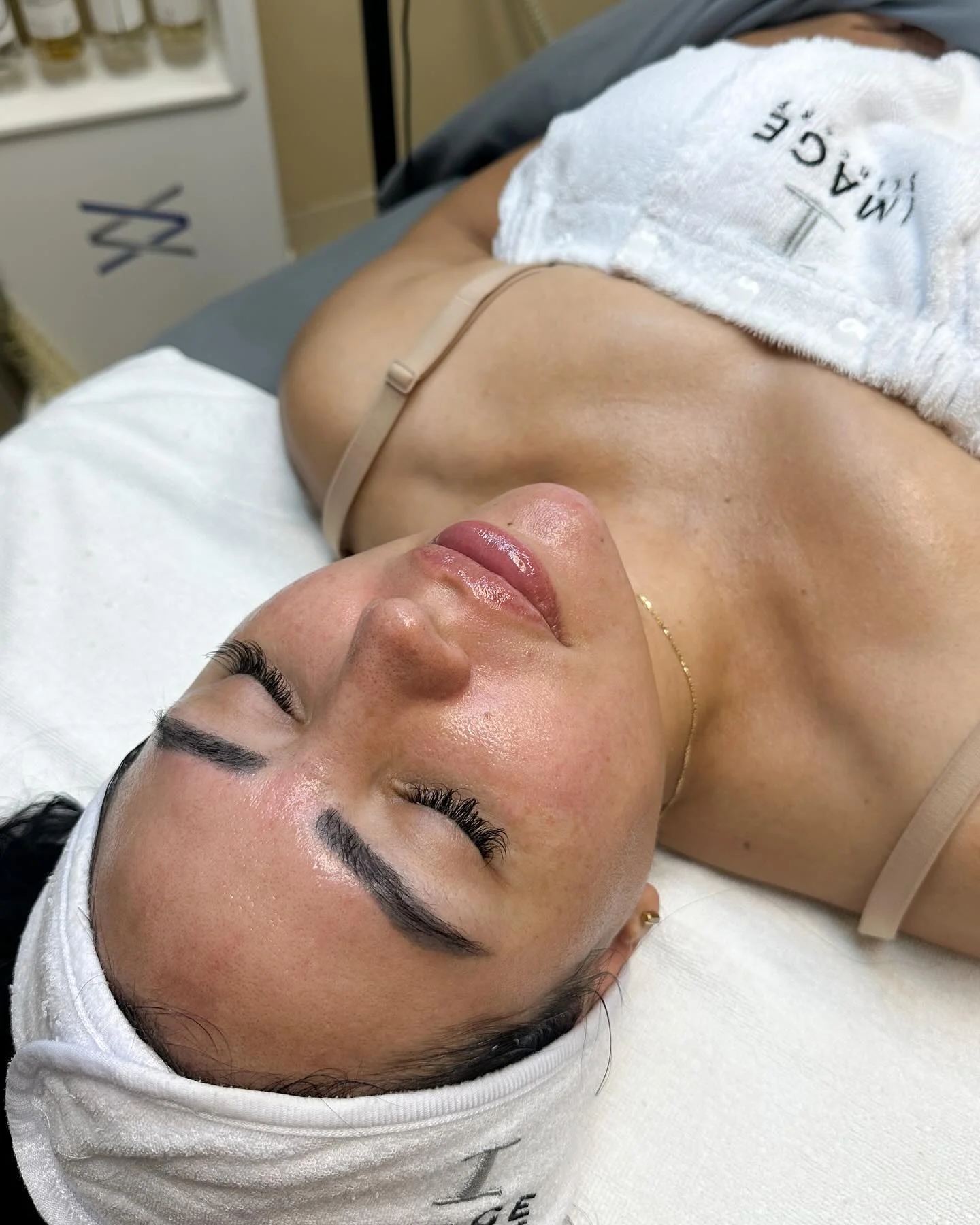 Hydrated, glowing skin after an Ormedic Lift