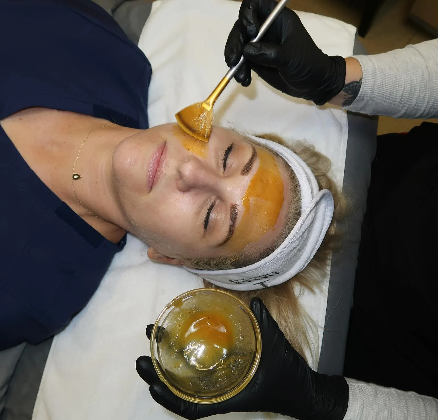 Pumpkin Peel applied to the skin during treatment