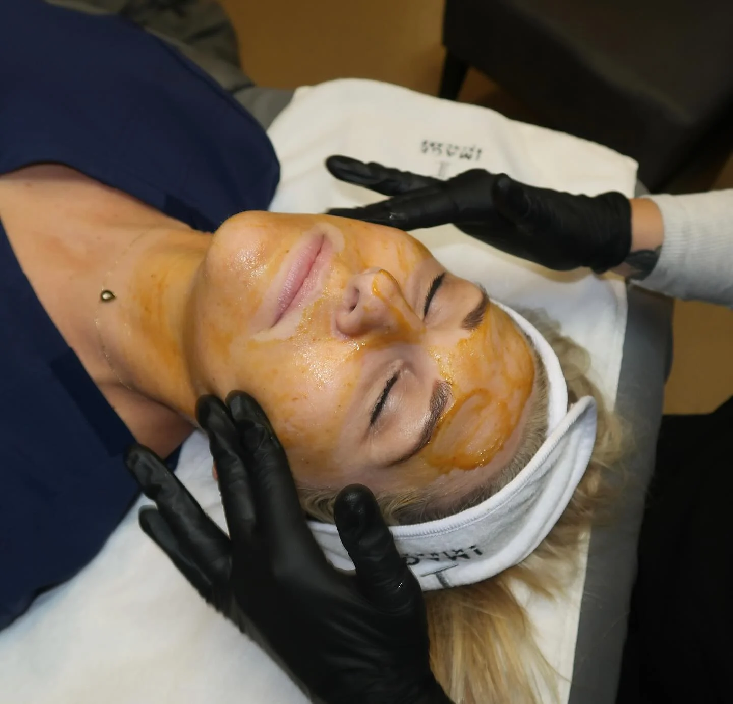 Removing the Pumpkin Peel during treatment