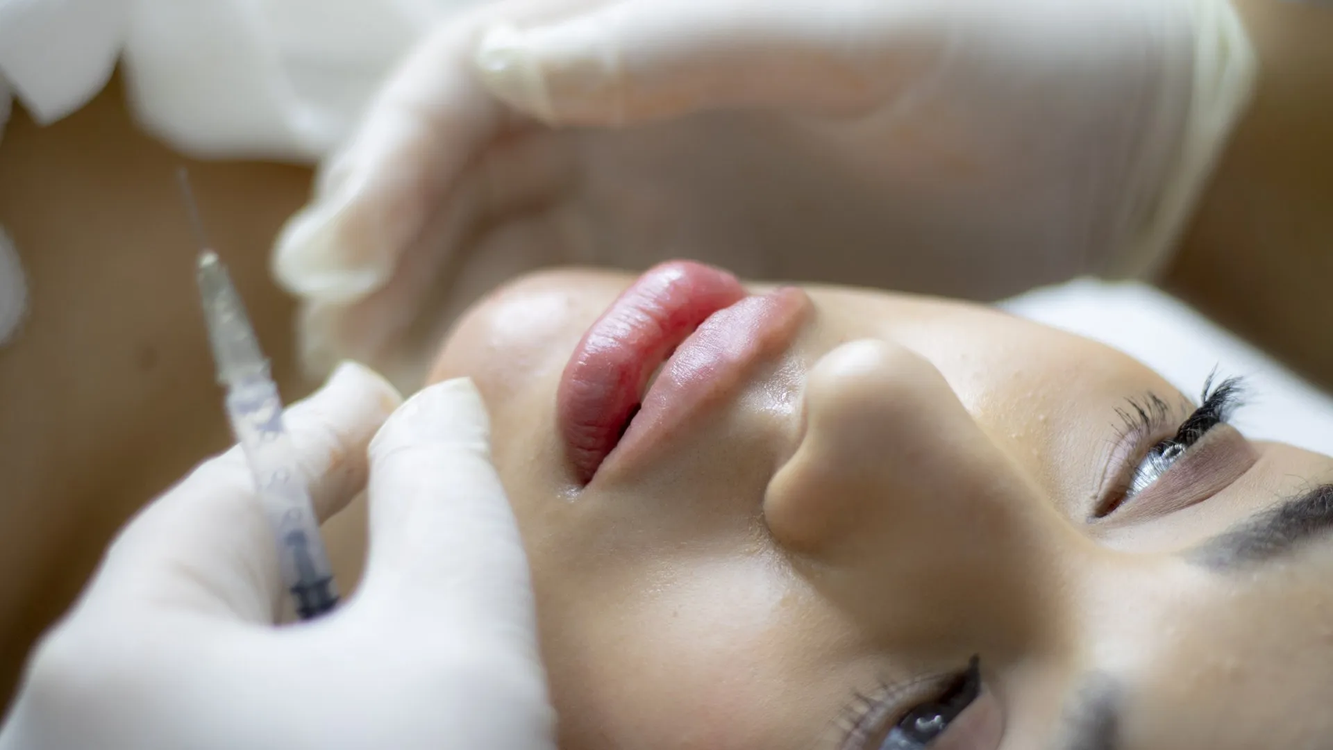 Injectable Fillers Treatment