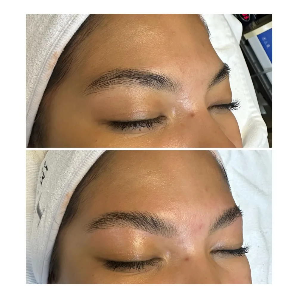 Brow lamination before and after results