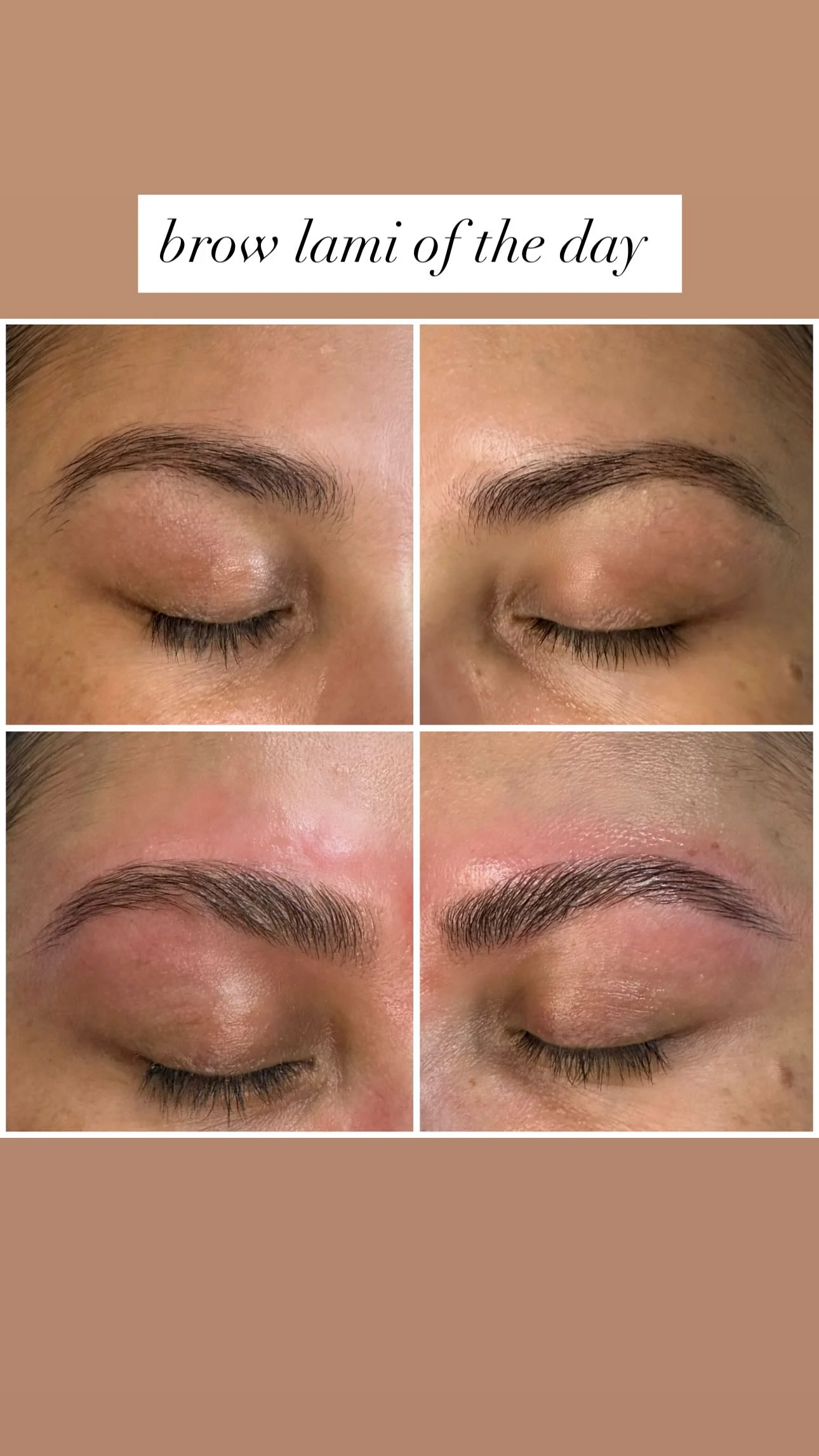 Brow lamination result