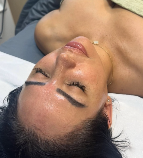 Signature facelift treatment products for facial peel