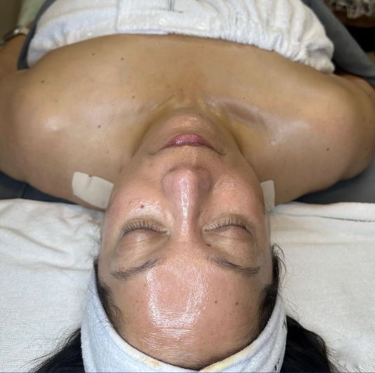 Wrinkle lift forte peel treatment products