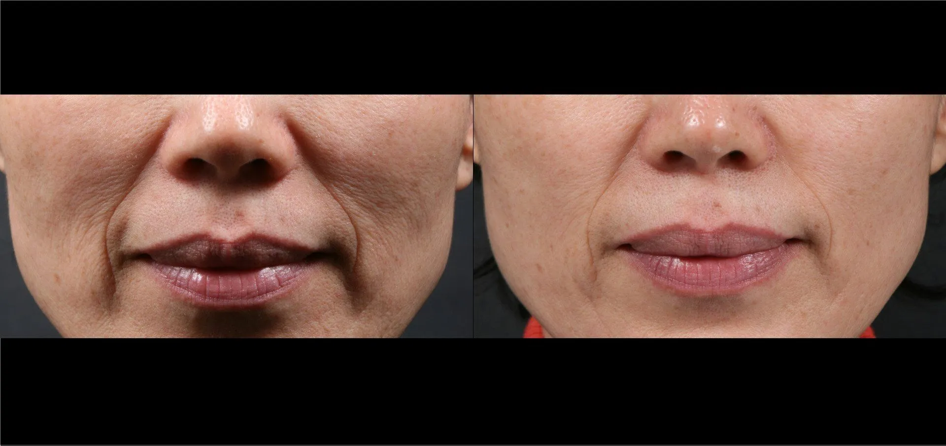 Potenza Before and After Result 3